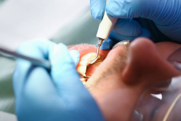 Best Emergency Dental Care for Broken or Chipped Teeth in Little Silver, NJ