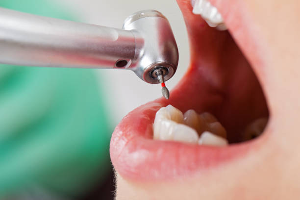 Best Pediatric Emergency Dentist in Little Silver, NJ